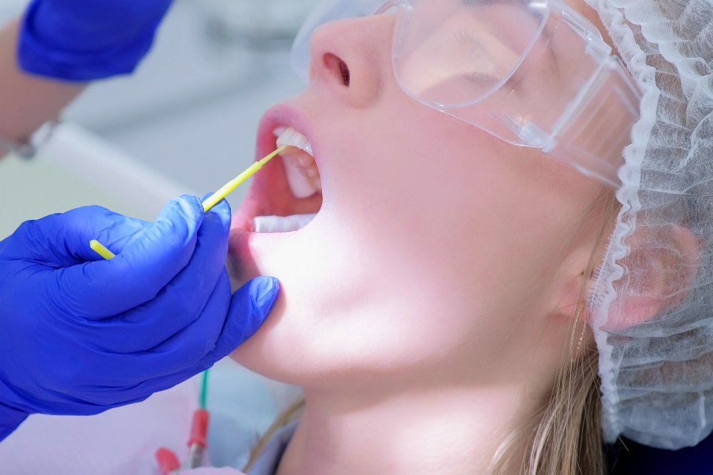 fluoride treatment brentwood