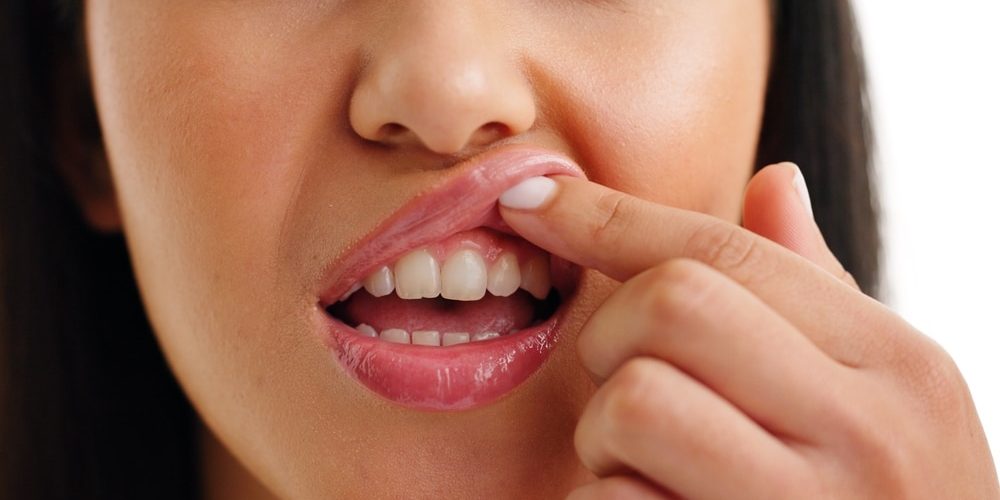 Mouth,,Teeth,Check,Or,Woman,In,Studio,With,Gum,Disease, can gingivitis be reversed